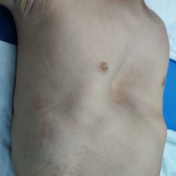 Before surgery