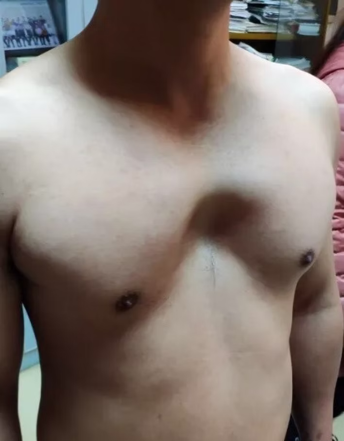 Dr. Wang collaborating with Pakistani doctors during surgery