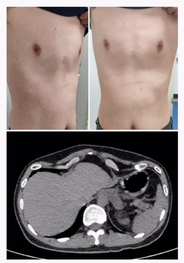 saddle chest