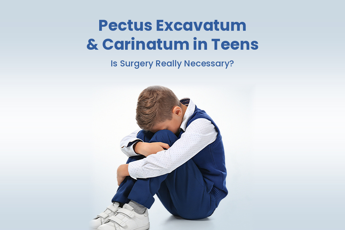Pectus Excavatum and Pectus Carinatum in Teens: Is Surgery Really Necessary?