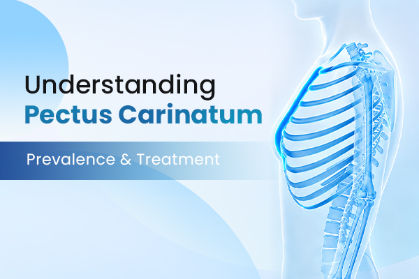 prevalence and treatment of pectus carinatum